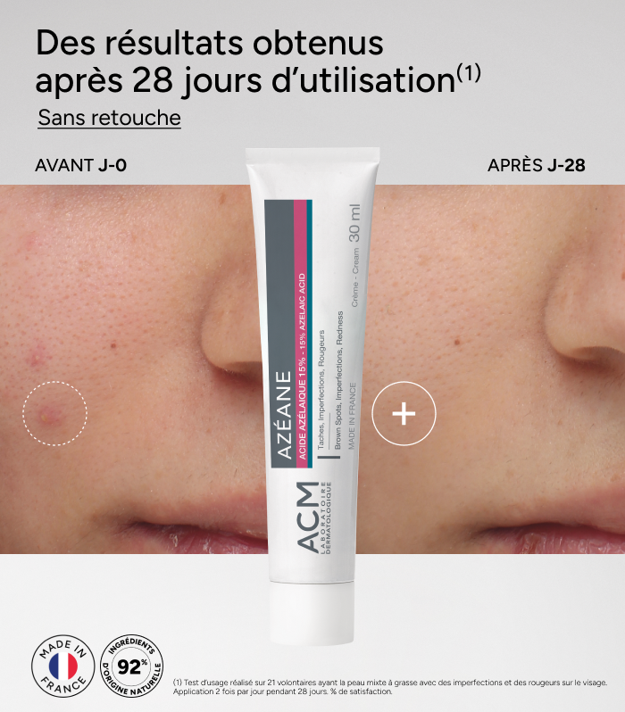 ACM Azéane Crème 15% Acide Azélaïque - 30 g