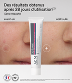 ACM Azéane Crème 15% Acide Azélaïque - 30 g